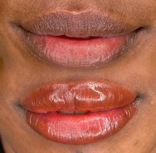 Dark Lip Neutralisation
